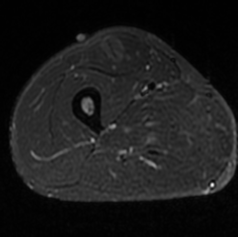 МРТ мягких тканей