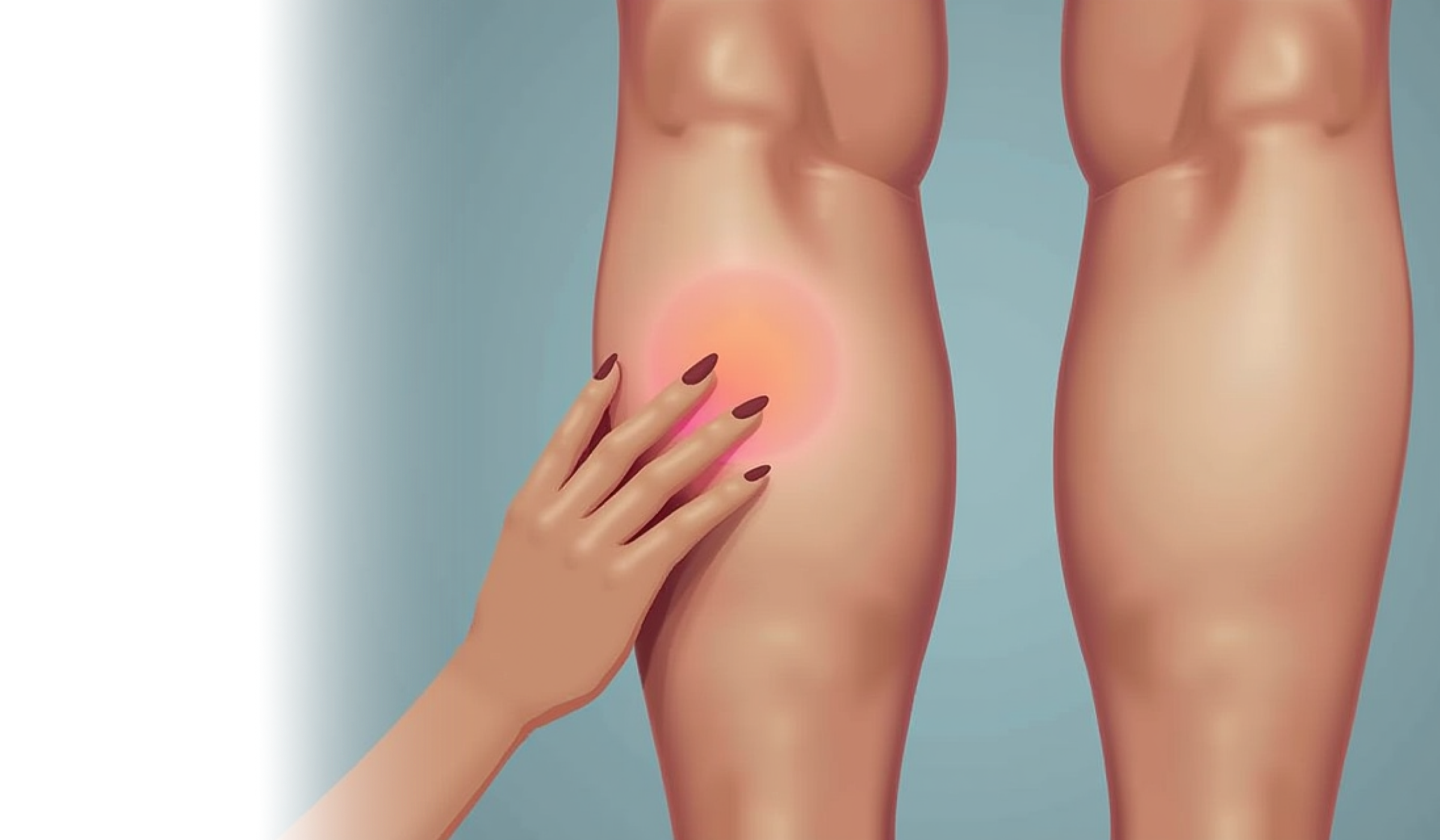 Перевязка перфорантных вен