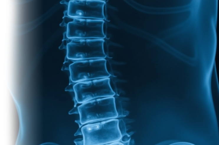 Ультрасонография межпозвонковых дисков