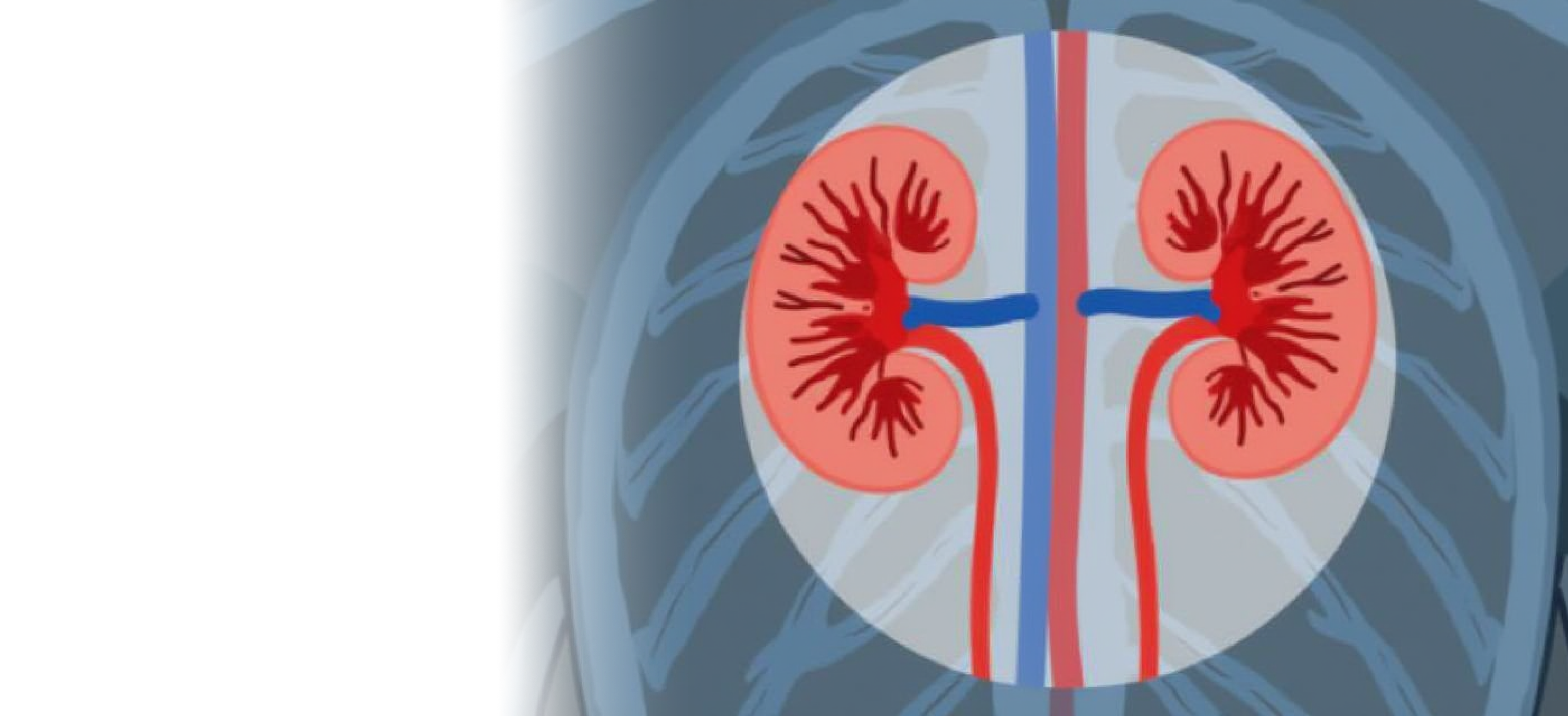 Лечение заболеваний почек