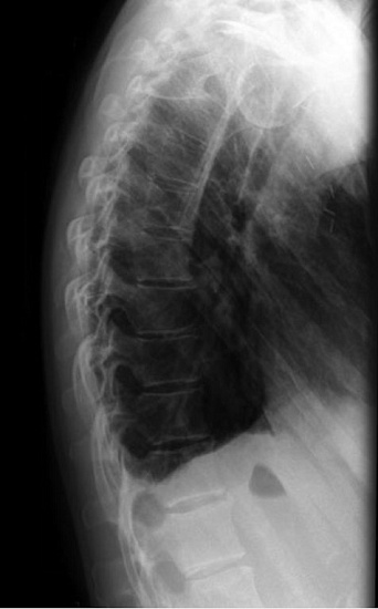 Рентгенография органов грудной клетки