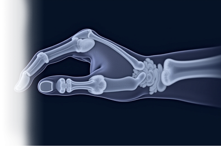 УЗИ мелких суставов кисти